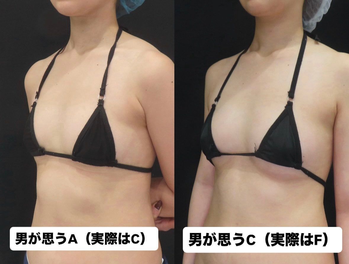 [討論] 醫師：動漫胸部太大 害男性誤會 - 希洽 - PTT.BEST 批踢踢爆文 3
